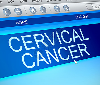 子宫颈癌信息概念图片