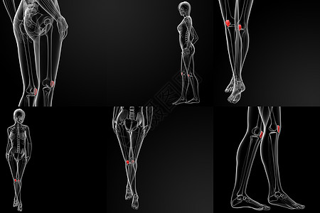 3D 显示骨骼的立体插图肌腱腓骨症状压力蓝色解剖学手术股骨运动软骨图片