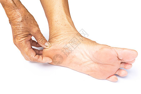 握着手脚 老妇老妇人 用白色的背灰来照顾自己的感觉老化女性父亲糖尿病成人祖母手指皱纹护理女士图片