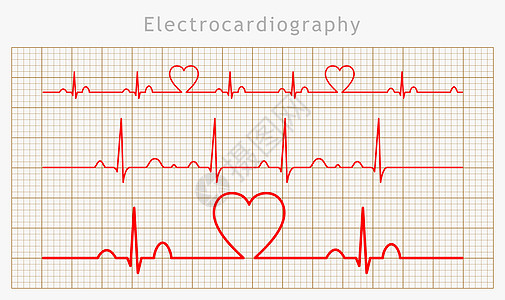 矢心心心心心血管图表集光束药品诊断心脏病学图表医院速度海浪心脏病测试图片