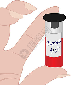 用于实验室分析和诊断的手中的血液试管卫生血压诊所保健胰岛素验血生物学医院检查管子图片