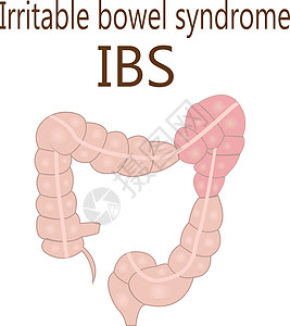 大肠肠易激综合症 IBS微生物学器官疾病疼痛冒号诊断腹部微生物感染插图图片