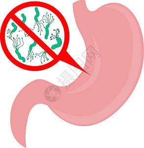 停止胃中的幽门螺杆菌肠胃空气毒素胃炎消化症状气味细菌消化系统气体图片