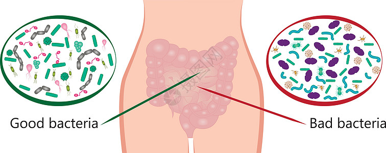 实验性细菌植物 好坏细菌 矢量图解插图微生物病菌肠胃疾病生物大肠杆菌图表植物群感染图片