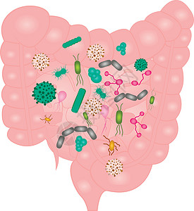 停止小肠矢量插图中的细菌过度增长( U)图片