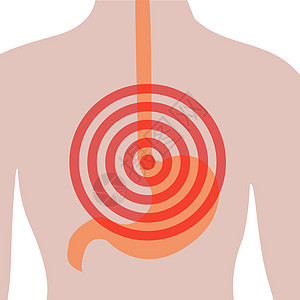人类身体的胃痛 腹部疼痛 心灼伤 消化系统紊乱图片