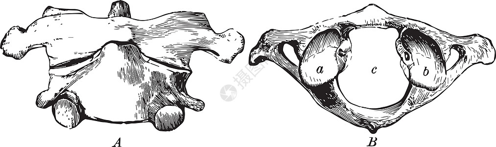 第一和第二子宫颈白喉 陈年插图图片