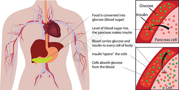 人体信息图中的血糖葡萄糖吸收图片