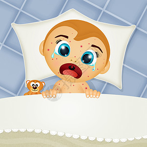 患有麻疹的婴儿插图药品疾病注射眼泪皮肤烦恼感染孩子康复图片