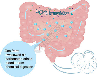 肠内胀气和过量气体细菌毒素寄生虫卫生胃炎空气疾病腹胀胃肠病症状背景图片
