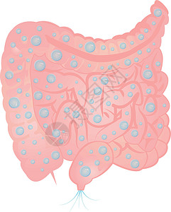 肠内胀气和过量气体细菌腹胀卫生疾病胃肠病毒素寄生虫消化消化系统空气图片