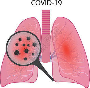 受冠状病毒感染 COVID1 影响的肺部实验室微生物学药品病人技术感染放大镜医疗科学呼吸图片