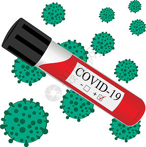 冠状病毒感染实验室分析用血液试管微生物学汇率生物学市场呼吸感染生物医疗药品技术图片