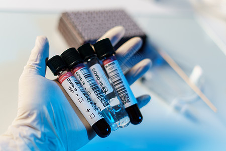 Corona病毒测试过程 手握血液测试Sam的血管诊断治疗微生物学样本科学暴发微生物危害试管工具图片