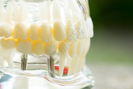 牙科医生的一套设备工具 假牙植入器测试治愈雕刻师手术座位钻头健康牙科医院刮刀图片