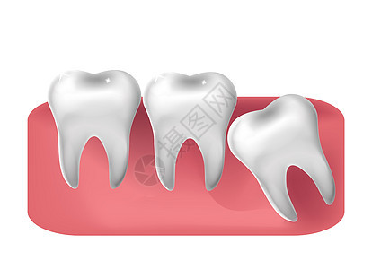 智齿切入 3d 逼真的风格 拔牙概念 它制作图案矢量图片