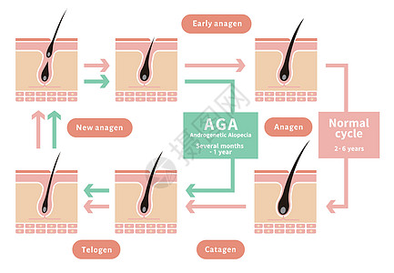 正常毛发周期与AGA雄激素性脱发的对比图生长细胞解剖学脱发化期头皮沙龙身体卫生乳突图片