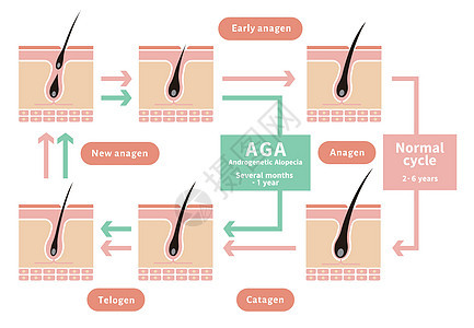 正常毛发周期与AGA雄激素性脱发的对比图生长细胞解剖学脱发化期头皮沙龙身体卫生乳突图片