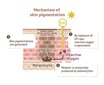 皮肤色素沉着皮肤斑点图案制作机制皮肤科过敏表皮粉刺插图老化器官素沉着卫生组织图片