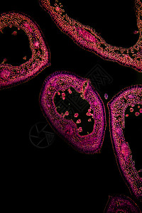 草莓树叶横过第100节x暗场红色黑色渡槽植物学细胞组织学场所劳动截面图片