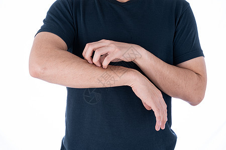 男性在孤立的白色背景上抓着他的手臂 医疗 为广告概念提供保健疾病药品发痒身体皮肤科湿疹手指过敏男人划痕图片