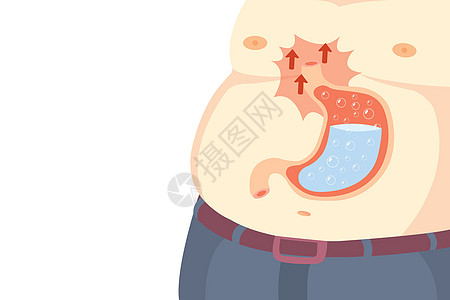 胃炎是由多种原因引起的 胃炎老少皆宜标识信息消化疼痛烧伤解剖学男人药品食管疾病图片