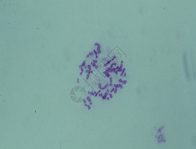 细胞核心中的染色体遗传考试药品宏观紫色医生诊断实体物质疾病图片