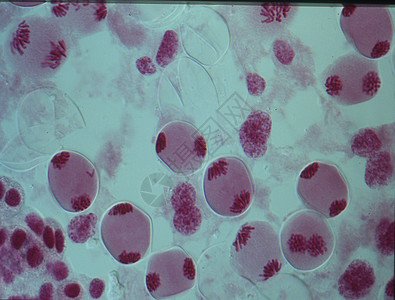 细胞核心中的染色体紫色物质药品遗传诊断宏观实体疾病考试医生图片