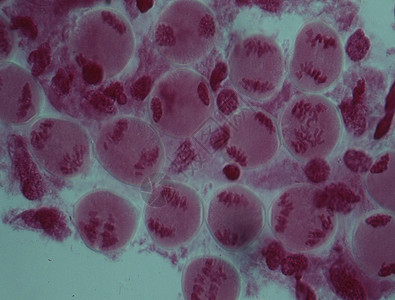 细胞核心中的染色体诊断医生物质考试实体遗传药品紫色宏观疾病图片