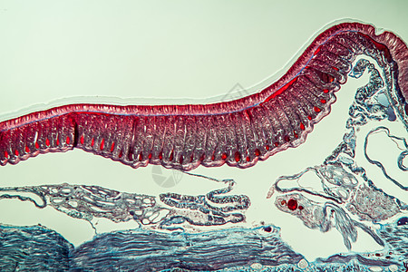 第10部分第100节的地虫病理学肌肉科学横截面蠕虫蚯蚓组织学组织药品宏观诊断图片