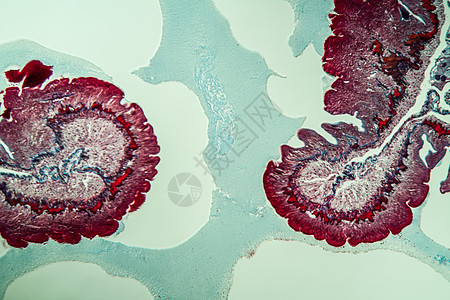 第10部分第100节的地虫病理学考试科学肌肉药品横截面组织蚯蚓组织学蠕虫调查图片
