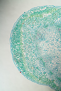 牧羊人钱包皮单上的Candida酵母100x寄生虫草药细胞薄片宏观植物杂草真菌感染科学酵母图片