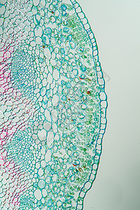 牧羊人钱包皮单上的Candida酵母100x科学薄片杂草酵母寄生虫真菌感染细胞生物学草药植物图片