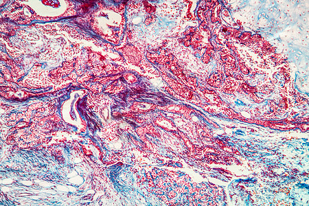 100x 疾病组织100x纤维放大镜蓝色宏观癌症细胞上皮药品科学腮腺图片