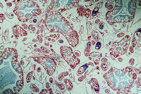 肝流感组织感染第100节吸虫红色吸盘宏观扁虫疾病主持人科学寄生虫水蛭图片