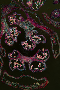 显微镜下的 Alder 猫果站 100x组织学叶脉水管细胞果序科学植物学组织放大镜薄片图片