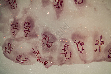 带状结构的染色体 放大400x组织学细胞分裂韧带遗传细胞植物学科学生长果蝇宏观图片