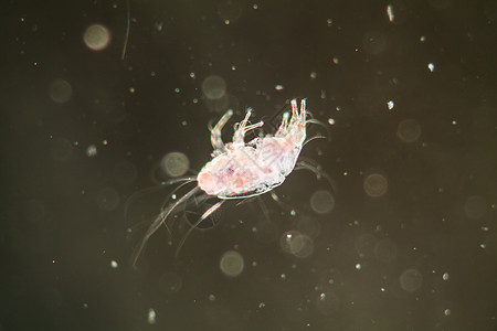 显微镜下的房屋灰尘泥口器害虫螨虫疾病暗场寄生虫过敏科学宏观图片