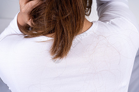头发掉落的问题 头发倒下来的后针盖着头发 医疗或日常生活概念女士治疗脱发秃顶护理卫生疾病梳子化疗损失图片