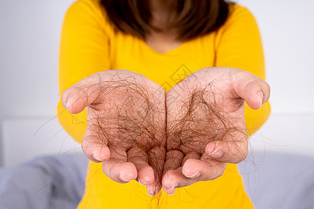 毛发掉落的问题 紧身手握有问题头发 保健医疗或日常生活概念秃顶刷子卫生护理秃头梳子癌症脱发女士成人图片