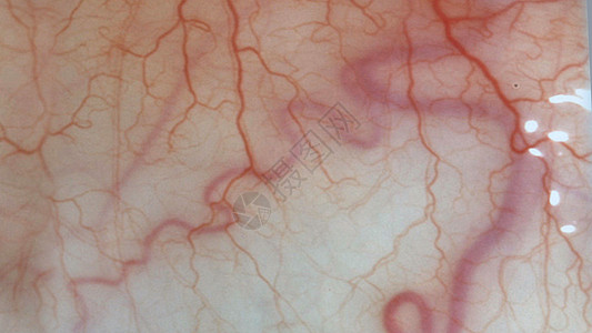 人类的眼神闭着血管的图象神经皮肤眼睛静脉知识医疗眼部动脉图片