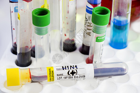H1N1猪流感 诊断和化验 血液测试管样本 文本和信件唱歌危险肺炎实验室治疗发烧技术液体预防药品图片