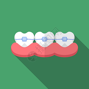 以长阴影显示牙科牙牙套图标的现代矢量插图门户网站金属牙医微笑程序牙疼创造力支撑健康解剖学图片