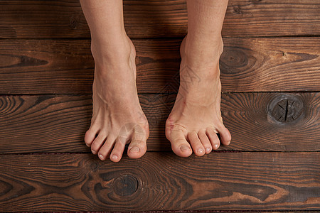 女性双腿上的紧闭木本底成人治疗解剖学手指保健骨科病人疾病组织状况图片