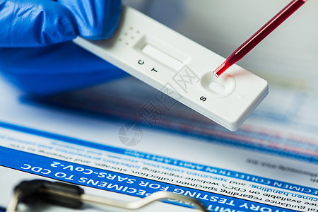 医学实验室技术人员使用吸管将血样标本放在快速诊断测试上图片