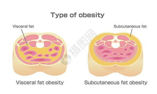 日本的肥胖插图类型 腹部剖视图 内脏脂肪 皮下脂肪重量身体横截面饮食医疗数字男人科学损失代谢图片