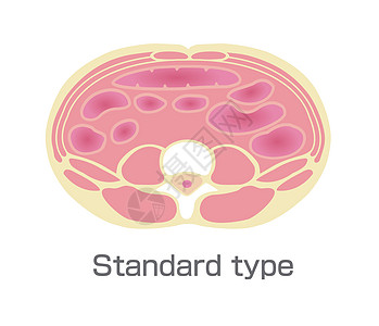 肥胖例证的类型 腹部剖视图 健康体型 标准型数字身体疾病药品科学横截面生活方式损失医疗糖尿病图片