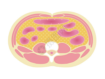 日本的肥胖插图类型 腹部剖视图内脏 fa药品卫生保健男性男人糖尿病脂肪生物学医疗数字图片