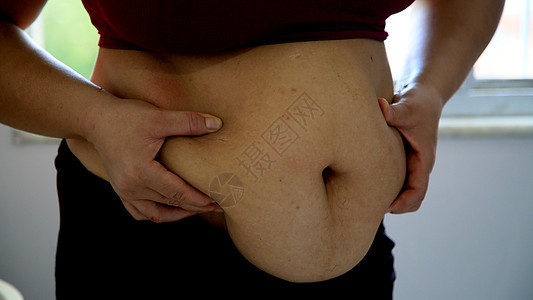 腹部脂肪累积外科饮食手术健康薄度女孩重量女士减肥女性图片