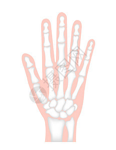 手骨平面矢量图人体解剖学三角骨卫生男人医生手腕生物学手术疼痛骨头身体图片